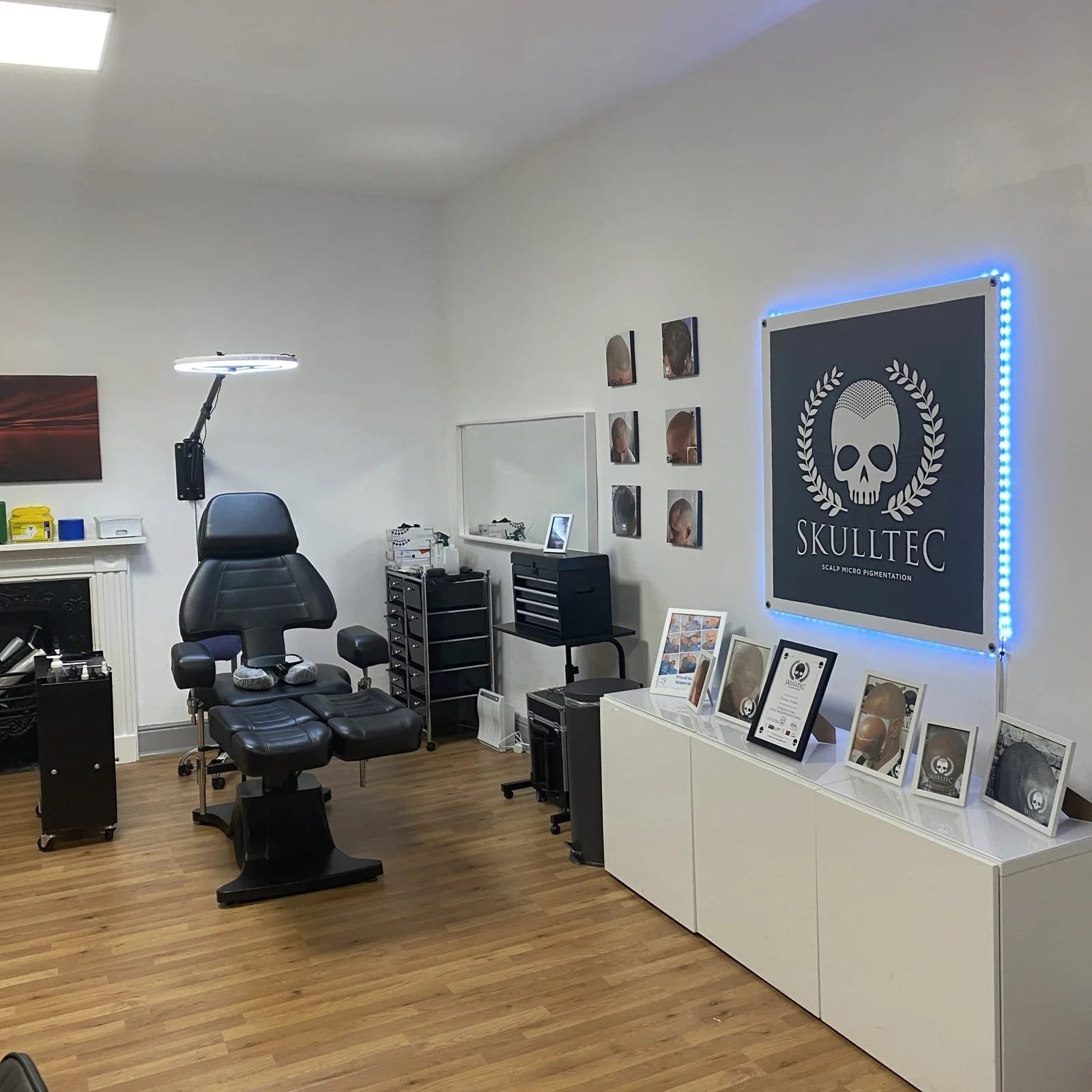 Skulltec : Scalp Micropigmentation In South East England