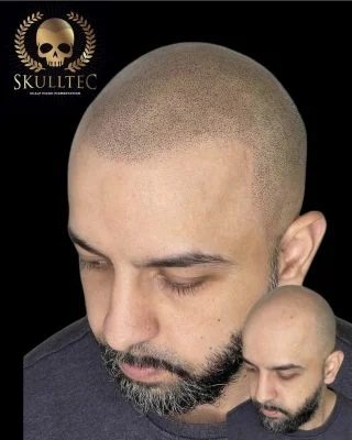 Tattoo Hairline for Men | Hair Tattoo for Men by Skulltec