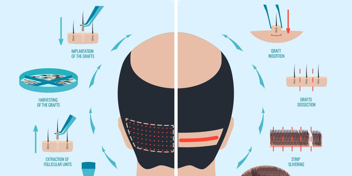 Best Treatment Options For Thin Hair Restoration Naturally