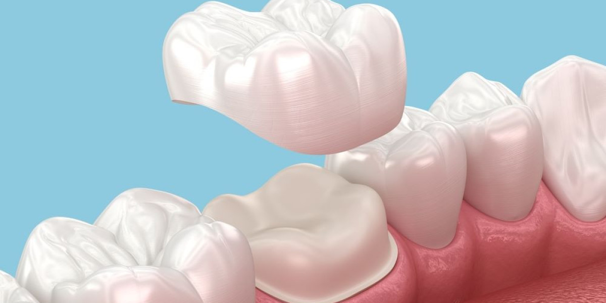 Caring for Your Dental Crowns to Extend Longevity