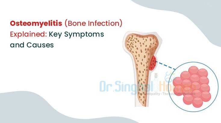 Osteomyelitis: Key Symptoms, Causes & Early Warning Signs
