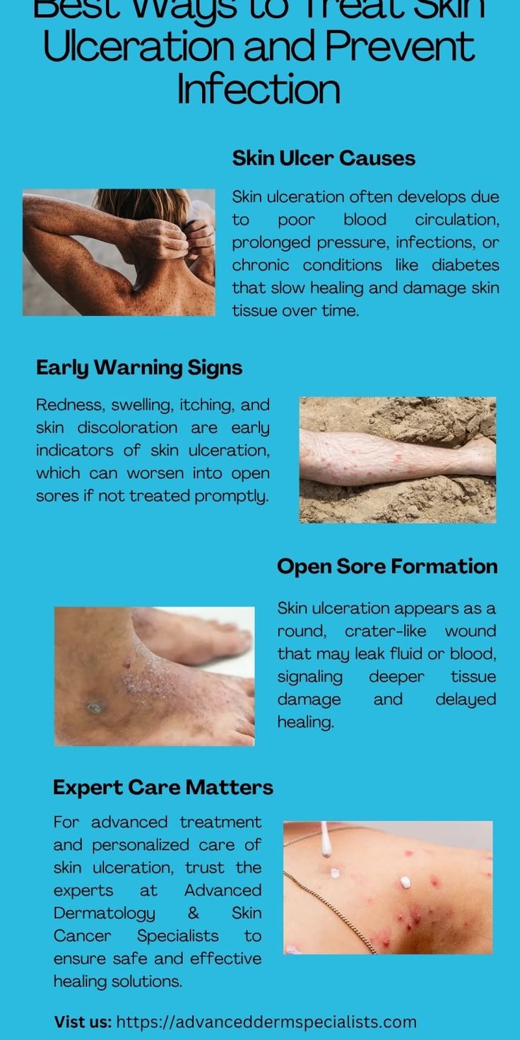 Pin on SRT dermatology