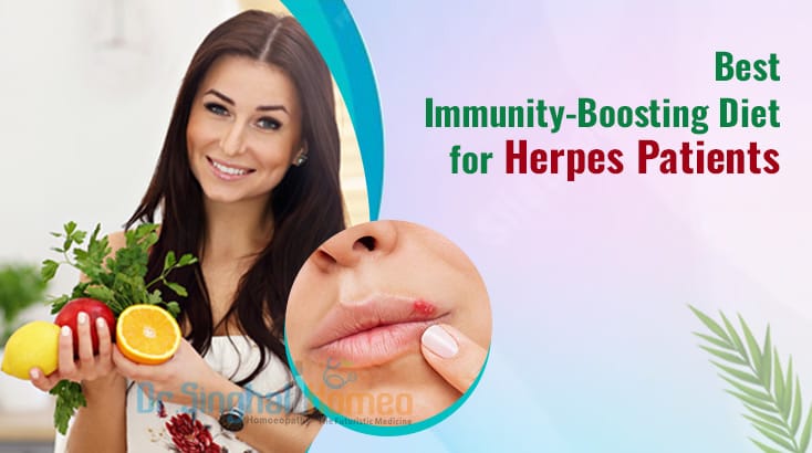 Find the Best Herpes Diet and Homeopathic Treatment for Relief