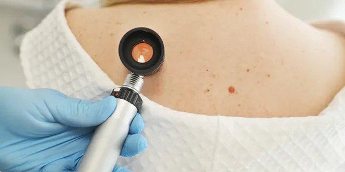 Avoid Scars With Skin Cancer Treatment in California | Articles | Advanced Dermatology Skin Cancer Specialists | Gan Jing World - Technology for Humanity | Video & Movie Streaming