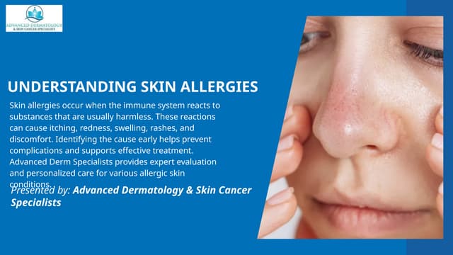 Professional Skin Allergy Diagnosis and Treatment Solutions.pptx