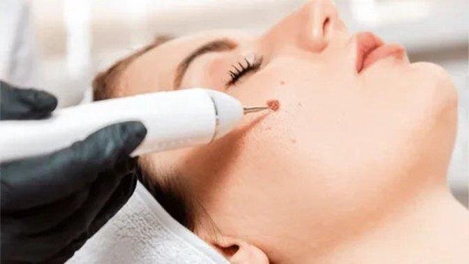 How to Choose the Right Clinic for Mole Removal in Stockton | Articles | Kevinnn | Gan Jing World - Technology for Humanity | Video & Movie Streaming