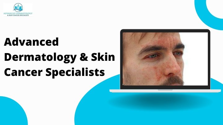PPT - Private Psoriasis Treatment for Lasting Skin Health and Relief PowerPoint Presentation - ID:14923222