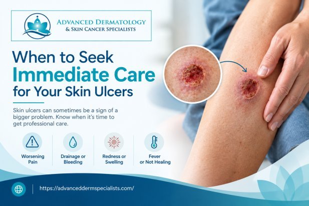 When to Seek Immediate Care for Your Skin Ulcers Article - ArticleTed -  News and Articles