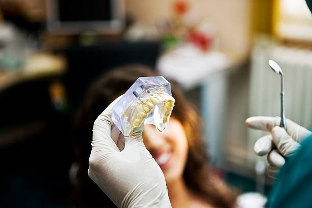 Full-Arch Tooth Replacement: What Are Your Treatment Options? – Telegraph